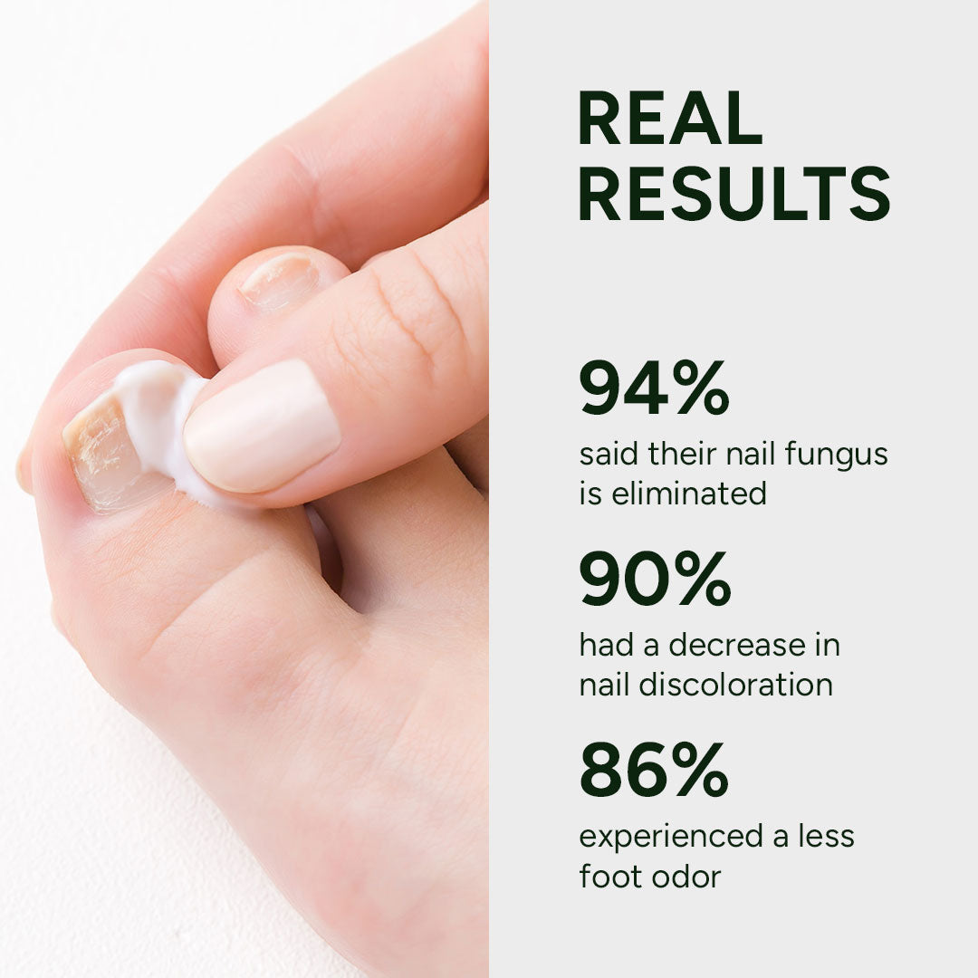 Nail Fungus Treatment Gel – NutraBoost
