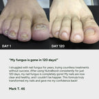 Anti-Fungal & Recovery Bundle